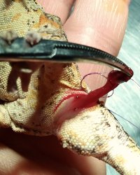 Applicazione di un punto di sutura alla base dell’emipene
